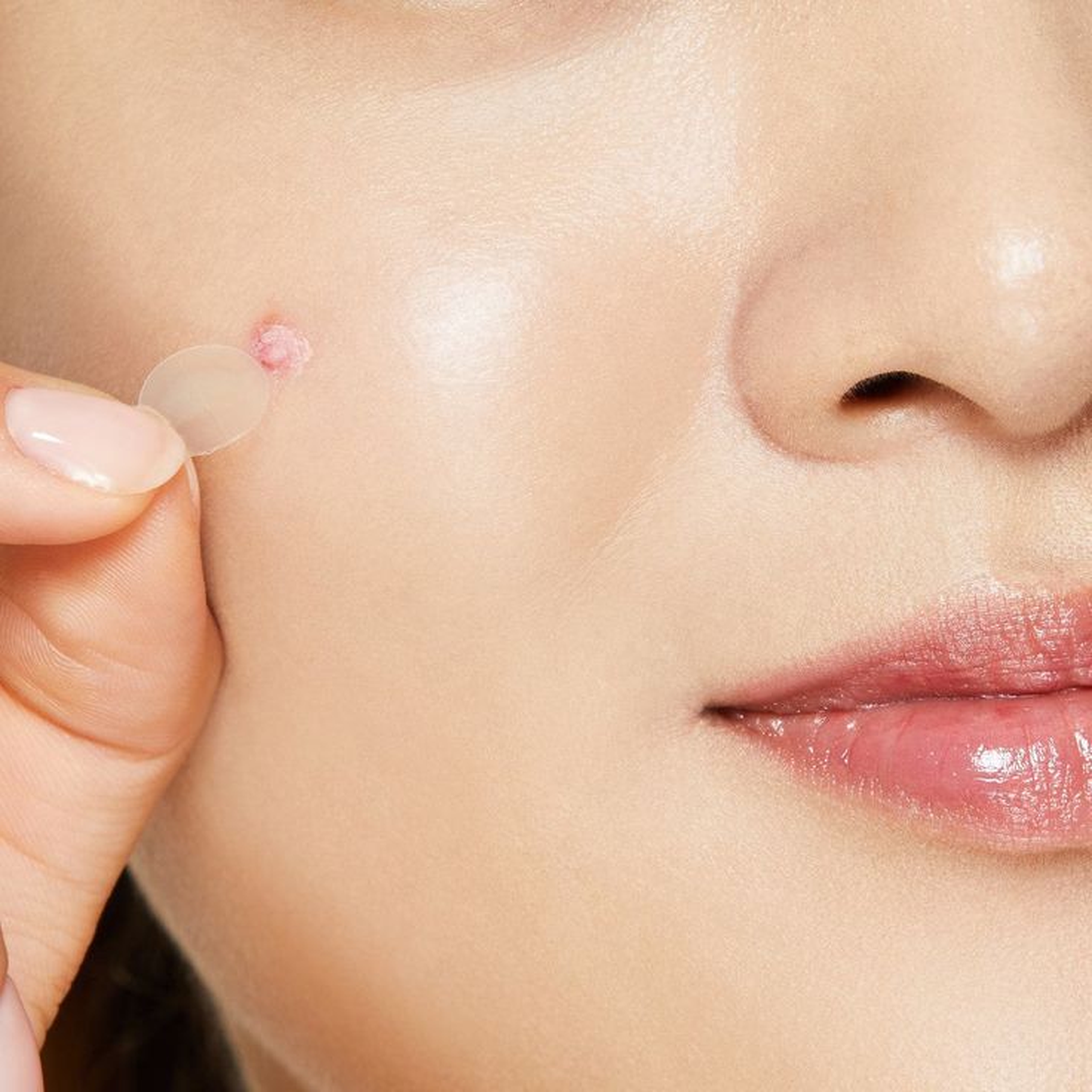 Cosrx Acne pimple master patch